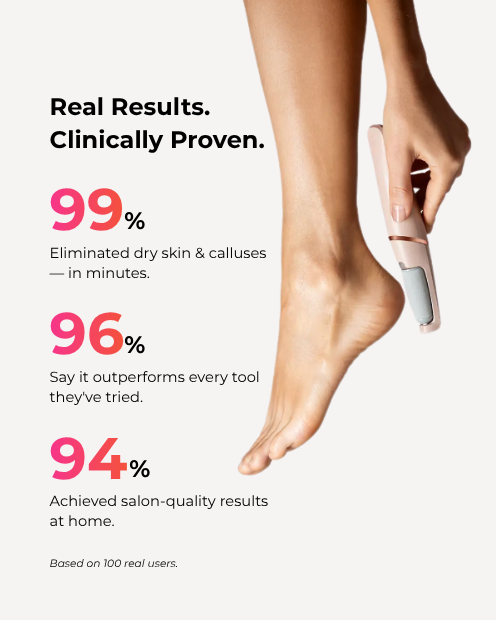Foot Callus Remover Household Removable